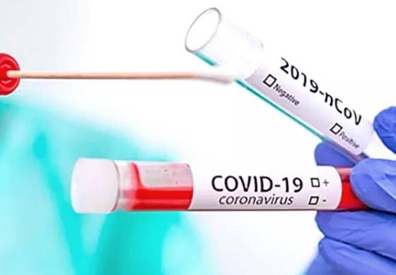 Как подготовиться к сдаче ПЦР-теста на COVID-19?